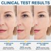 2 Pack Advanced Retinol Firming Serum Stick for Tightening & Firming Wrinkles, Laugh Lines, Neck & Face & Chest, Enchanced Hydrating & Anti-Aging Serum, Hypoallergenic & Safe for All Skin Types, 1 Oz view 4