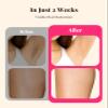 LYSMOSKI Laser Hair Removal for Women and Men, at-Home IPL Hair Removal Device with 5.2 cm Treatment Window, Nearly Painless, Visible Results in 2 Weeks, Full Body Treatment in 8 Minutes view 3