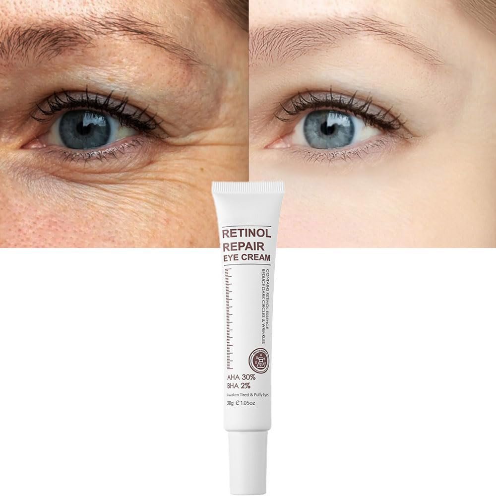Magic Retinol Eye Cream for Dark Circles Puffiness and Bags Under Eyes, Instant Results Firm Eye Tightener, Anti Aging Under Eye Cream for Men Women, Reduce Fine Lines Wrinkles and Age Spots - 1.06 Oz