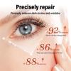 Magic Retinol Eye Cream for Dark Circles Puffiness and Bags Under Eyes, Instant Results Firm Eye Tightener, Anti Aging Under Eye Cream for Men Women, Reduce Fine Lines Wrinkles and Age Spots - 1.06 Oz view 2