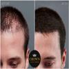 CROWN Hair Building Fibers (28g) - Instantly Cover Fine & Thinning Hair for a Thicker, Fuller Look - A Natural Keratin Concealer - 13 Shades for Men & Women - White view 3