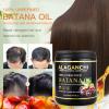 Batana Oil for Hair Growth and Strength | 100% Unrefined | 100% Pure Batana Oil from Honduras | For Thicker, Fuller, and Healthier Hair | 250 ml Large Size view 3