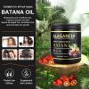 Batana Oil for Hair Growth and Strength | 100% Unrefined | 100% Pure Batana Oil from Honduras | For Thicker, Fuller, and Healthier Hair | 250 ml Large Size view 4