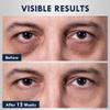 Oxbraver Eye Bags Treatment for Men: Caffeine Eye Cream with Cooling Roller - Reduces Puffiness, Dark Circles - Hydrating Daily Under Eye Cream view 3