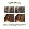 ALFHEIM Saw Palmetto Scalp Serum for Boost Follicle - Infused With Caffeine, Biotin for Thicker Hair - Balance Scalp, Rejuvenate Hair Follicles  Improve Hair Density - 1.69 fl oz + Serum Applicator view 2