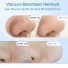 Blackhead Remover Vacuum with Heat & Cold Care, Black Head Remover for Face & Nose with Camera, Rechargeable Blackhead Vacuum Extractor with 3 Modes 5 Suction Levels & 6 Replaceable Heads view 4