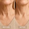HeeHom Celestica Instant Neck Lift Tape - Invisible Support for Turkey Neck & Wrinkles, 4 Elastic Bands + 20 Skin-Toned Patches (90x40mm) (1pack) view 4