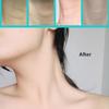 HeeHom Celestica Instant Neck Lift Tape - Invisible Turkey Neck Tightener for Women, Lift & Firm Sagging Skin, 90x40mm Patches (20+4 Bands) (1pack) view 3