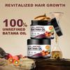 100% Unrefined Raw Batana Oil for Hair Growth Dr. Sebi Organic Pure from Honduras with Keratin, Coffee Extract & Other Ingredients to Enhance Efficacy for Thicker, Strengt view 2