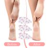 6Pcs Moisturizing Socks Overnight for Dry Cracked Feet, Cotton Sleep Socks Sleep Sock with Floral Print for Women Men, Soft Feet Moisturizer Sock for Softening, Care After Pedicure view 2