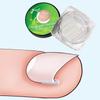 10Pcs Ingrown Toenail Correction Strips Brace Kit,Ingrown Toenail Corrector Straightener Strips Recover Clips Toenails Thick Toenail Strip for Men Women Foot Care Tool,Pedicure Tool for Men and Women view 3