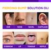 MURASAKI BEAUTY Piercing Bump Solution Oil, 1.06 fl oz, Aftercare Treatment (2 Pack) view 3