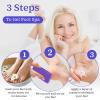 200 Pcs Pumice Stone Bulk for Feet Scrubber,Dead Skin Disposable Foot Pumice Foot Callus Remover Pedicure Tools Purple Pumice Sponge Nail Salon Home Use view 3