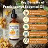 2 Pack Frankincense Resin Oil for Face, Reduces Fine Lines & Wrinkles, Soothes Irritated Skin, Face Anti-Aging Anti-Wrinkles Hydrates Frankincense Essential Oil for Wrinkle view 4