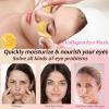32 Pairs Eye Masks & Lip Masks, Collagen Crystal Lip Mask and Eye Mask, Crystal Collagen Eye Patches for Puffy Eyes, Effectively Eliminates Dark Circles and Eye Bags, Reduces Lip Wrinkles view 2