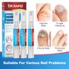 Toenail Fungus Treatment Extra Strength - DR.RAPID Toenail Fungus Treatment Pen with 25% Undecylenic Acid & Tolnaftate, Ideal for Fungus Treatment for Damaged Nails & Fingernails 5ml/0.18FLOZ 3Pcs view 4