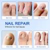Fungal Nail Patches 21 PCS, Toenail Treatment Extra Strength 8-Hour Overnight Nail Fast Acting Repair Effortless Hydrogel Nail Care and Repair for Damaged Nails Overnight Renewal for Men and Women view 4
