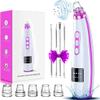 Blackhead Remover Pore Vacuum Upgraded Pore Cleaner Electric Whitehead Extractor Tool-5 Suction Power,5 Probes,USB Rechargeable Blackhead Vacuum view 1