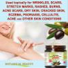 Botanical Beauty Whipped OLIVE OIL BUTTER 100% Natural Pure Organic Cocoa Butter, Shea Nut Butter, Organic Olive Oil Virgin Unrefined for FACE, SKIN, BODY, HAIR, NAILS. (8 Fl Oz) view 4