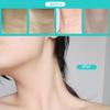 Celestica Instant Necks Tapes, Celestica Necks Tapes, Lift Tape Invisible Behind Neck for Special Events & Makeup-Friendly Use, Lift Strap Patch Tightening Tapes (1Set20Pcs, One Size) view 4