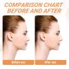 5 Pcs Nose Lifter - Nose Shaper Clip  Instant Nose Lift Kit, Painless Straightening Beauty Tool Kit for Women/Men (Black, Clear) view 4