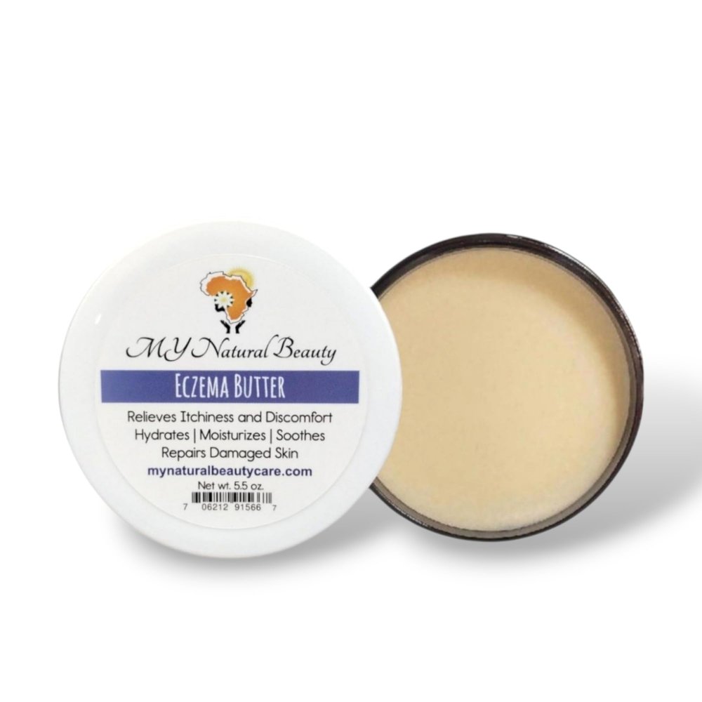 Eczema Butter (5.5 oz.), Intense Body Moisturizer for Eczema, Psoriasis & Dry Cracked Skin, Eczema Treatment for Children and Adults. Gentle and Deep Moisturizing Body, Face, and Scalp. All-Natural - Allergen FREE