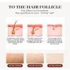 Beauty Painless Hair Removal Device view 3