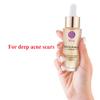 Repairing Serum Reduce Dark,Red spot Fills in acne scars to make them smooth, 15 ml.(0.52 Oz.) view 2