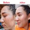 Repairing Serum Reduce Dark,Red spot Fills in acne scars to make them smooth, 15 ml.(0.52 Oz.) view 3