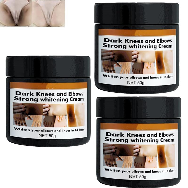 2025 new 1/2pcs Crema Para Manchas Oscuras En La Cara Pink Privates Intimate Area cream crema Para Las Manchas De La Cara,Para Piel Entrepierna,Manchas Codos,Piernas Zonas,Rodillas Cuello (3pcs)