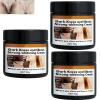 2025 new 1/2pcs Crema Para Manchas Oscuras En La Cara Pink Privates Intimate Area cream crema Para Las Manchas De La Cara,Para Piel Entrepierna,Manchas Codos,Piernas Zonas,Rodillas Cuello (3pcs) view 1