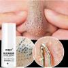 DLUOCYNFD Blackhead Extraction Liquid Deeply cleanses, shrinks pores, delicately softens and removes Blackhead Nasal mask view 2