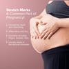 N'ua Stretch Marks Oil | 100% natural ingredients | Rosehip oil and coconut oil | Reduces and Prevents the appearance of marks | Soothes itchiness and dryness | Quick-absorbing, lightweight formula view 3