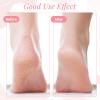 3 Pairs Moisturizer Socks Coral Aloe Socks Non Slip for Dry Feet Cracked Heel Spa Sleeping Travel Lounge Wear Stress Relief Gifts Repairing (Pink, Green, Blue) view 4
