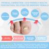 InhwRior Ingrown Toenail Corrector, Easy At-Home Application, Secure Fit (No Slipping Off), Steady Traction for Rapid Pain Relief, Waterproof for Shower & Swimming(0.75" to 0.83" Toenail Length) view 2