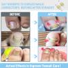 InhwRior Ingrown Toenail Corrector, Easy At-Home Application, Secure Fit (No Slipping Off), Steady Traction for Rapid Pain Relief, Waterproof for Shower & Swimming(0.75" to 0.83" Toenail Length) view 3