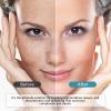 Tranxamic Acid 10% Serum, Discoloration Correcting Serum, Face Lotion with Moisturizing Effect, Natural Formula for Skincare view 4