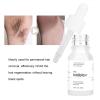 Hair Inhibitor for Face, Mild Hair Inhibitor Serum Natural Plant Extract Soothing Stop Hair Growth for Face Arm Leg Body Bikini (1PCS) view 2