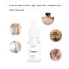 Hair Inhibitor for Face, Mild Hair Inhibitor Serum Natural Plant Extract Soothing Stop Hair Growth for Face Arm Leg Body Bikini (1PCS) view 4