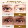 EJW Revive Eye Serum with Gentle Retinoid Correction for Under Eye Bags Wrinkles Puffiness, Fine Lines and Crows Feet, Hydrating & Firming Anti-Aging, Elevates Radiance and Revives Skin, 0.5 oz view 4