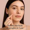 ZIANELLE Original patch  The #1 Hydrocolloid Acne Pimple Patch for Shrinking Zits and Whiteheads in 1 use; Nighttime Spot Stickers for Face and Skin (72 Count) view 2