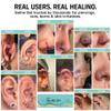 Base Labs Saline Gel 1.5oz  Piercing Aftercare & Piercing Bump Solution  Nose, Ear & Belly Button Piercing Care  Hydrating Gel for Piercings, Burns & Irritations  Aloe Vera, Tea Tree & Sea Salt view 4