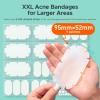 XXL Pimple Patches for Body, Large Hydrocolloid Acne Patches, 5 Sizes Big Hydrocolloid Bandages for Back, Chest, Shoulders Zit Breakouts, Blemish Patch for Face (Oval, Dot 260 Count) view 2