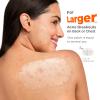 XXL Pimple Patches for Body, Large Hydrocolloid Acne Patches, 5 Sizes Big Hydrocolloid Bandages for Back, Chest, Shoulders Zit Breakouts, Blemish Patch for Face (Oval, Dot 260 Count) view 3