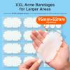 XXL Pimple Patches for Body, Large Acne Patches, 5 Sizes Big Hydrocolloid Bandages for Back, Chest, Shoulders Zit Breakouts, Blemish Stickers for Face (Oval, Dot 110 Count) view 2