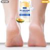 DIANA'S DREAM Hydrating and Anti-Cracking Foot Cream, 2025 Upgraded Moisturising and Relieves Cracking and Dryness Foot Cream, Foot Lotion Heel Balm Stick for Women & Girls (Honey) view 3