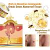 Bee Venom Comprehensive Cream, Professional Bee Venom Skin Treatment Cream, Bee Venom Skin Restoration Cream-50g, Repair, Moisturize and lift 3 in 1, for All skin Types (4 Pack) view 2