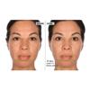 Active Argan Resurface Accelerating Peel, 1 fl. oz., with Vitamin C, AHA and BHA view 2