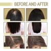 300ml Rosemary Shampoo- 5pcs Hair Repair Smooth Hair Gentle Nourish Shine Hair Care Essential Conditioner view 4