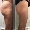 Bum bum Cream  Firming & Lifting Body Cream for Cellulite and Stretch Marks  With Natural Brazilian Extracts  8oz  Smooth, Hydrate & Tighten Skin  All Skin Types view 4